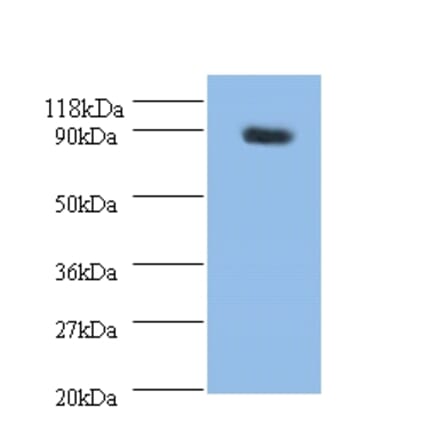 Rho guanine nucleotide exchange factor 7 Polyclonal Antibody from Signalway Antibody (42257) - Antibodies.com