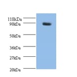 Rho guanine nucleotide exchange factor 7 Polyclonal Antibody from Signalway Antibody (42257) - Antibodies.com