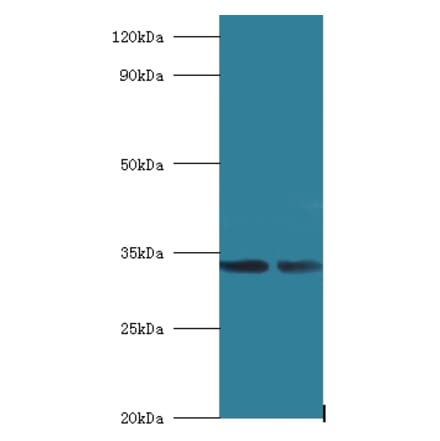 39S ribosomal protein L19, mitochondrial Polyclonal Antibody from Signalway Antibody (42259) - Antibodies.com