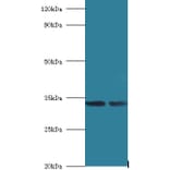 39S ribosomal protein L19, mitochondrial Polyclonal Antibody from Signalway Antibody (42259) - Antibodies.com