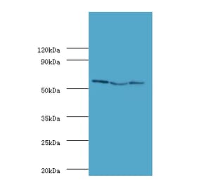 Ubiquitin carboxyl-terminal hydrolase 14 Polyclonal Antibody from Signalway Antibody (42364) - Antibodies.com