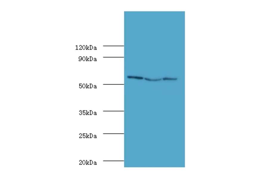 Ubiquitin carboxyl-terminal hydrolase 14 Polyclonal Antibody from Signalway Antibody (42364) - Antibodies.com