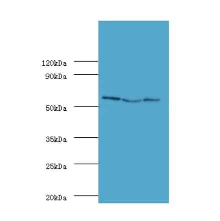 Ubiquitin carboxyl-terminal hydrolase 14 Polyclonal Antibody from Signalway Antibody (42364) - Antibodies.com