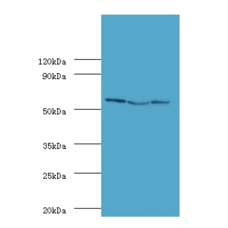 Ubiquitin carboxyl-terminal hydrolase 14 Polyclonal Antibody from Signalway Antibody (42364) - Antibodies.com