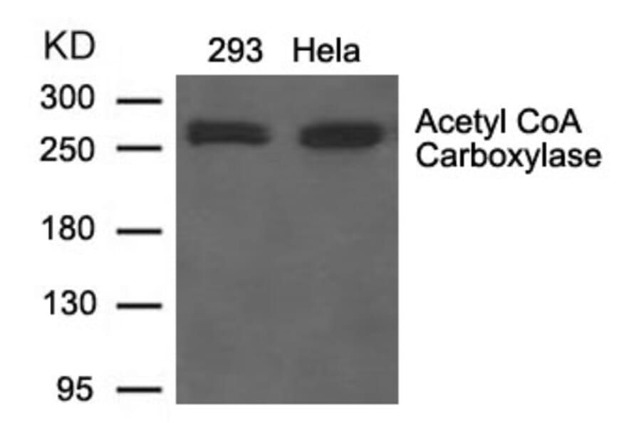Western blot - Acetyl CoA Carboxylase Antibody from Signalway Antibody (21583) - Antibodies.com