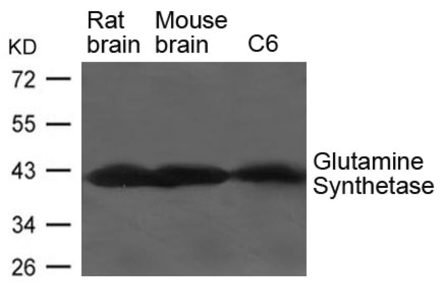 Western blot - Glutamine Synthetase Antibody from Signalway Antibody (21650) - Antibodies.com