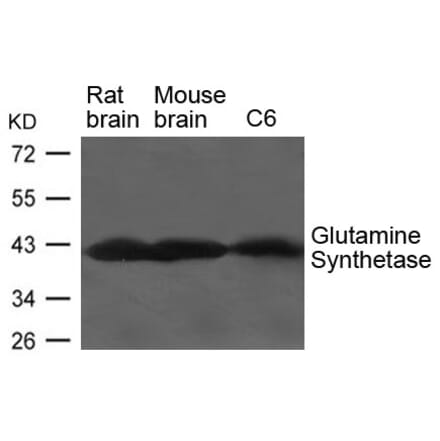 Western blot - Glutamine Synthetase Antibody from Signalway Antibody (21650) - Antibodies.com