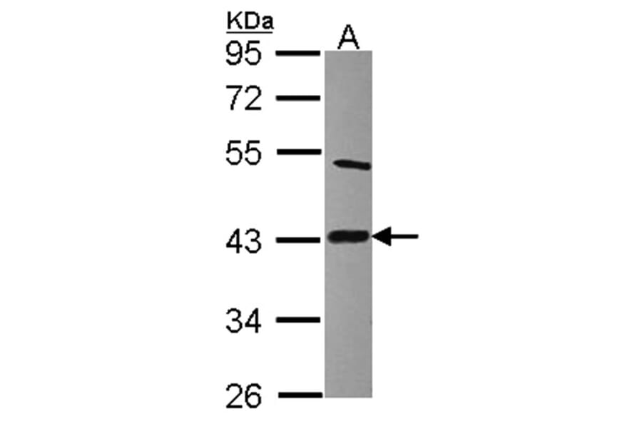 Lipoic acid synthetase antibody from Signalway Antibody (22243) - Antibodies.com