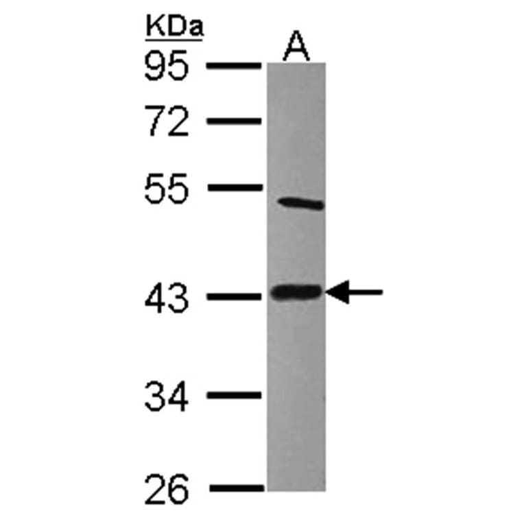 Lipoic acid synthetase antibody from Signalway Antibody (22243) - Antibodies.com