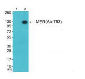 Western blot - MER (Ab-753) Antibody from Signalway Antibody (33314) - Antibodies.com