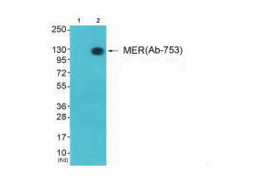 Western blot - MER (Ab-753) Antibody from Signalway Antibody (33314) - Antibodies.com