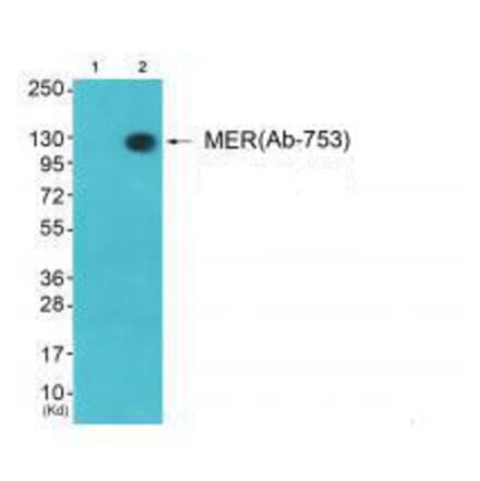 Western blot - MER (Ab-753) Antibody from Signalway Antibody (33314) - Antibodies.com