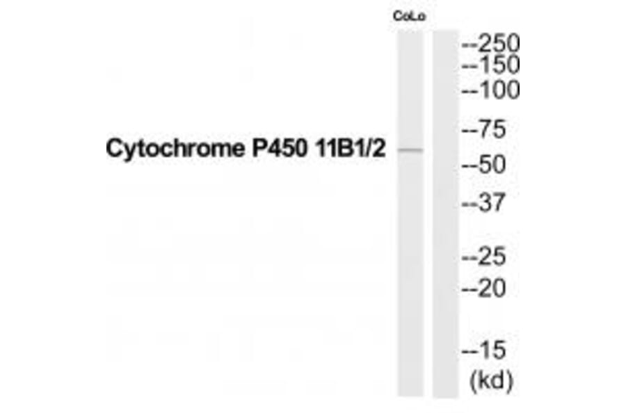 Western blot - Cytochrome P450 11B1/2 Antibody from Signalway Antibody (35212) - Antibodies.com