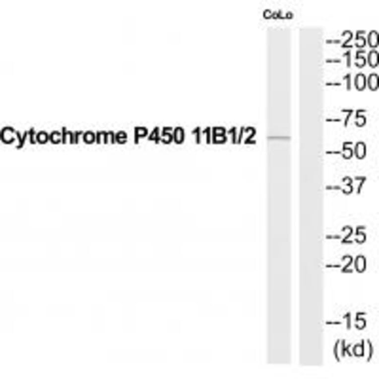 Western blot - Cytochrome P450 11B1/2 Antibody from Signalway Antibody (35212) - Antibodies.com