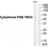 Western blot - Cytochrome P450 11B1/2 Antibody from Signalway Antibody (35212) - Antibodies.com