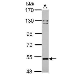 Cannabinoid Receptor 1 Antibody from Signalway Antibody (35345) - Antibodies.com