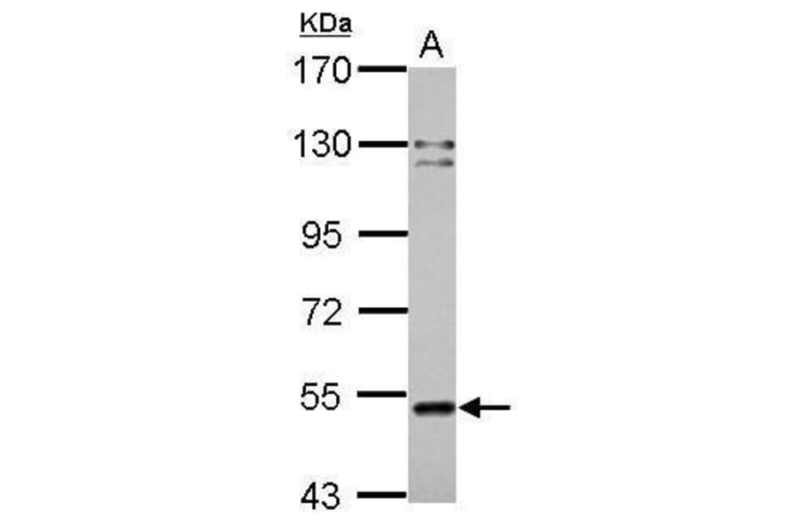Cannabinoid Receptor 1 Antibody from Signalway Antibody (35345) - Antibodies.com