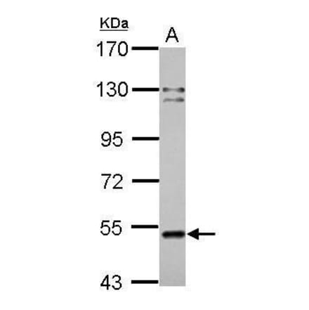 Cannabinoid Receptor 1 Antibody from Signalway Antibody (35345) - Antibodies.com