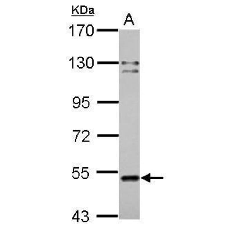Cannabinoid Receptor 1 Antibody from Signalway Antibody (35345) - Antibodies.com