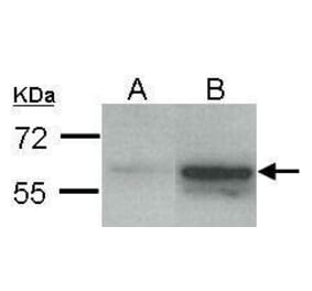 Estrogen Receptor beta Antibody from Signalway Antibody (35475) - Antibodies.com