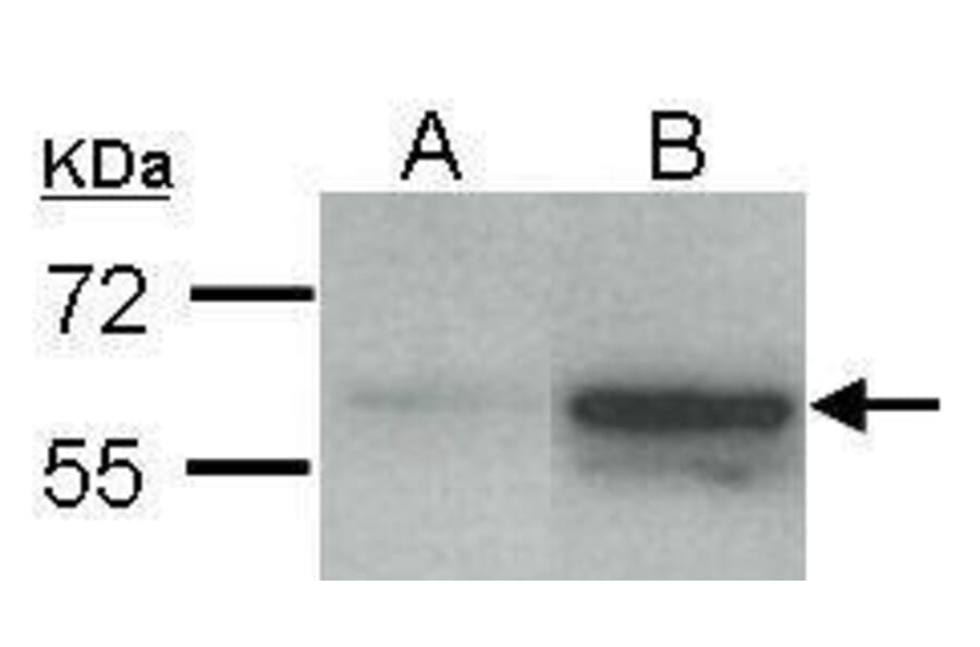 Estrogen Receptor beta Antibody from Signalway Antibody (35475) - Antibodies.com