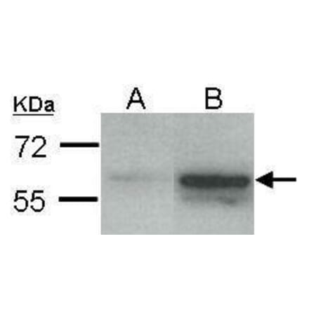 Estrogen Receptor beta Antibody from Signalway Antibody (35475) - Antibodies.com