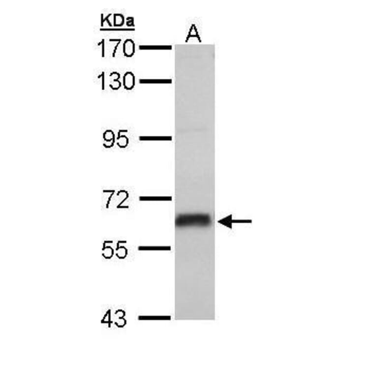 Estrogen Receptor beta Antibody from Signalway Antibody (35475) - Antibodies.com