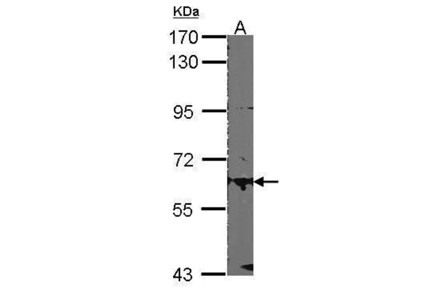 Estrogen Receptor beta Antibody from Signalway Antibody (35475) - Antibodies.com