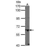 Estrogen Receptor beta Antibody from Signalway Antibody (35475) - Antibodies.com