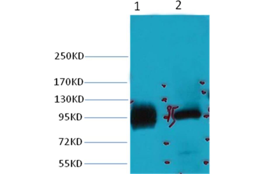 Western blot - ABCB5 Mouse Monoclonal Antibody from Signalway Antibody (38031) - Antibodies.com