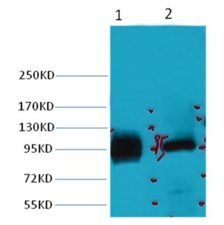 Western blot - ABCB5 Mouse Monoclonal Antibody from Signalway Antibody (38031) - Antibodies.com