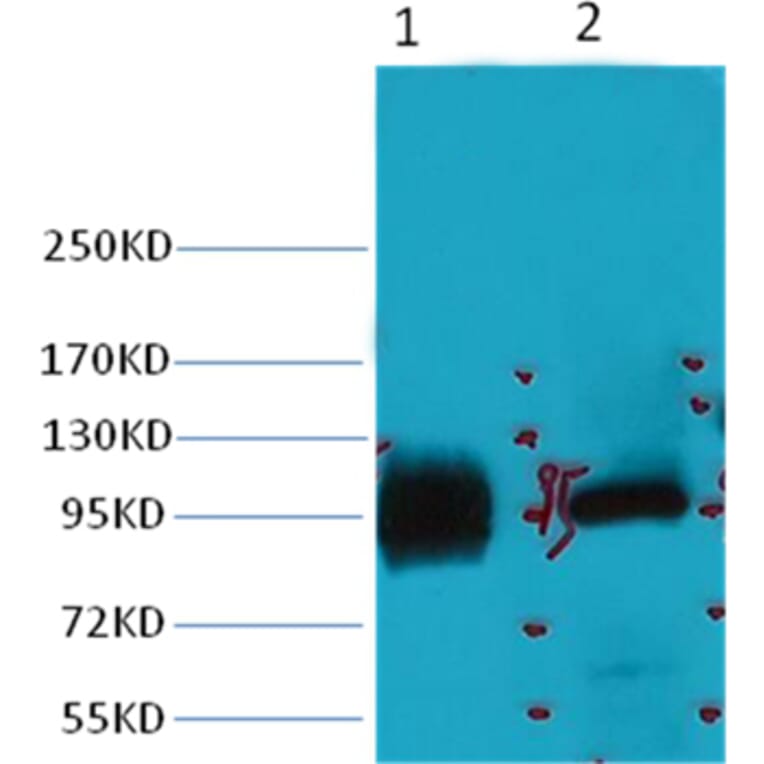 Western blot - ABCB5 Mouse Monoclonal Antibody from Signalway Antibody (38031) - Antibodies.com