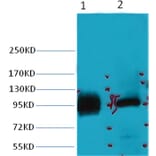 Western blot - ABCB5 Mouse Monoclonal Antibody from Signalway Antibody (38031) - Antibodies.com