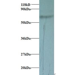 Transferrin Polyclonal Antibody from Signalway Antibody (42078) - Antibodies.com