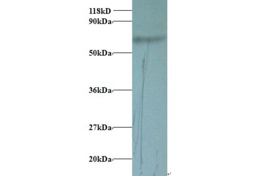 Transferrin Polyclonal Antibody from Signalway Antibody (42078) - Antibodies.com