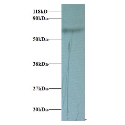Transferrin Polyclonal Antibody from Signalway Antibody (42078) - Antibodies.com
