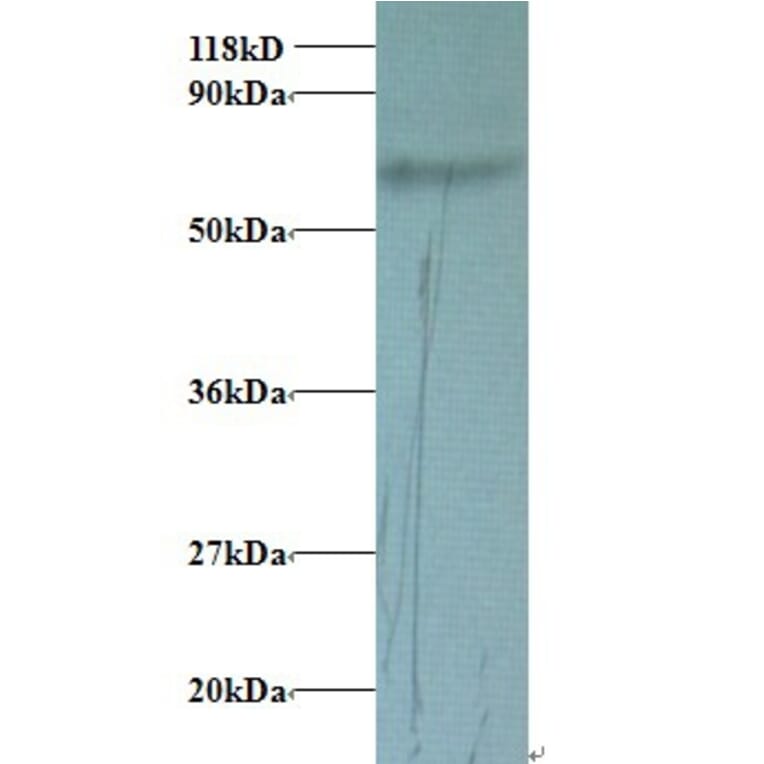 Transferrin Polyclonal Antibody from Signalway Antibody (42078) - Antibodies.com