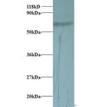 Transferrin Polyclonal Antibody from Signalway Antibody (42078) - Antibodies.com
