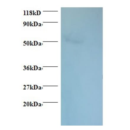 Rhombotin-1 Polyclonal Antibody from Signalway Antibody (42315) - Antibodies.com