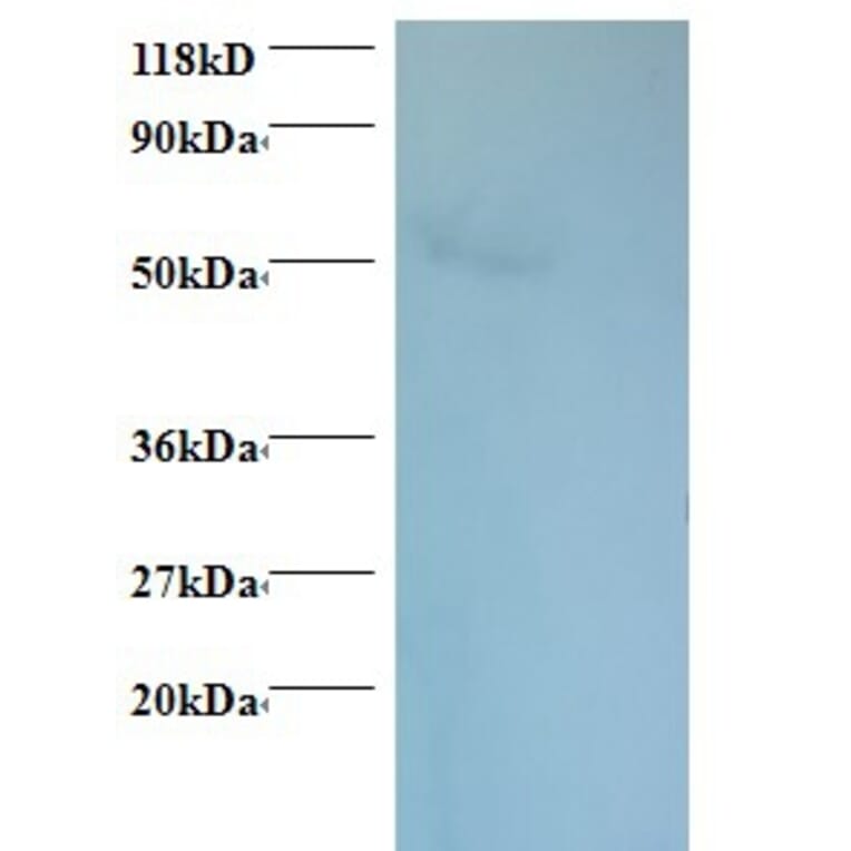 Rhombotin-1 Polyclonal Antibody from Signalway Antibody (42315) - Antibodies.com