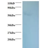 Rhombotin-1 Polyclonal Antibody from Signalway Antibody (42315) - Antibodies.com