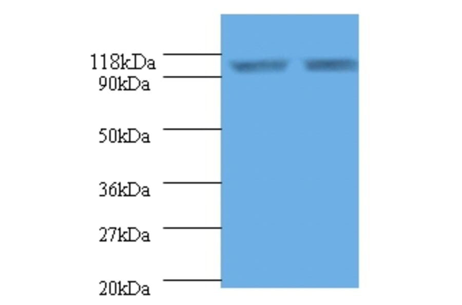 Endoplasmin Polyclonal Antibody from Signalway Antibody (42532) - Antibodies.com