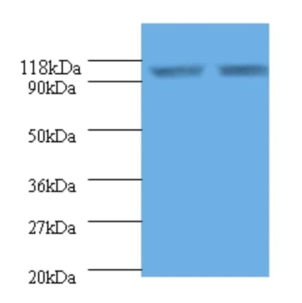 Endoplasmin Polyclonal Antibody from Signalway Antibody (42532) - Antibodies.com