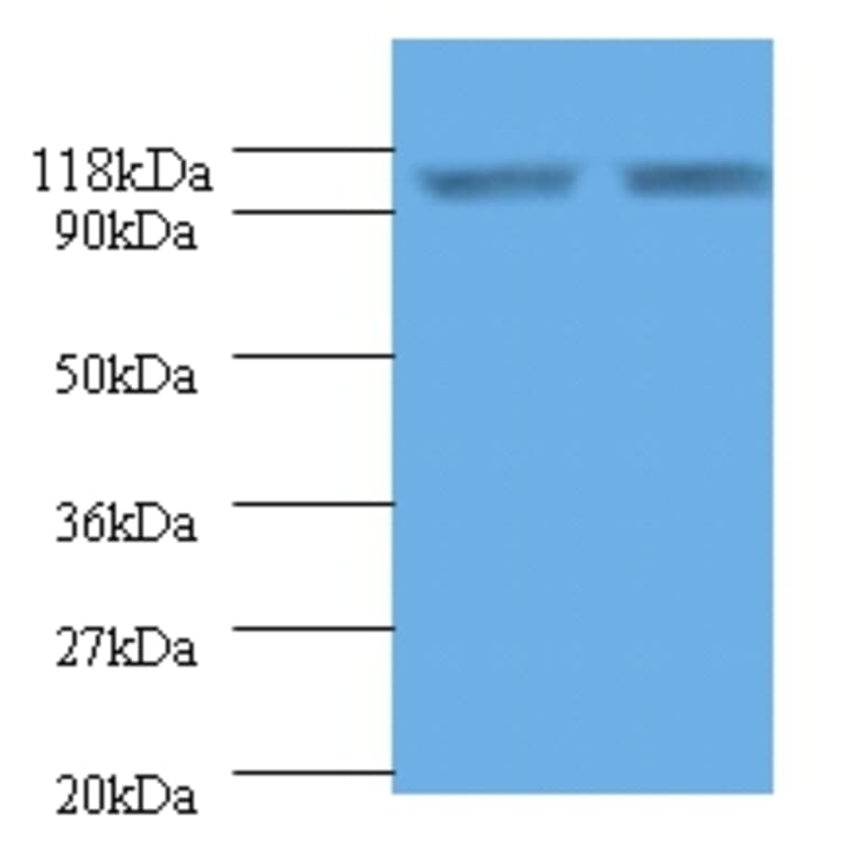 Endoplasmin Polyclonal Antibody from Signalway Antibody (42532) - Antibodies.com