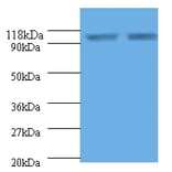 Endoplasmin Polyclonal Antibody from Signalway Antibody (42532) - Antibodies.com