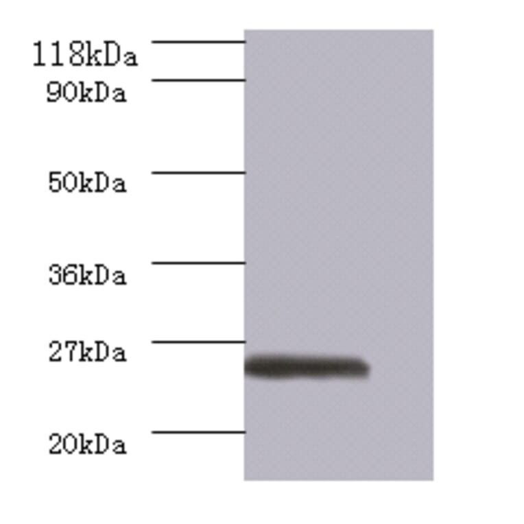 GTPase ERas Polyclonal Antibody from Signalway Antibody (42574) - Antibodies.com