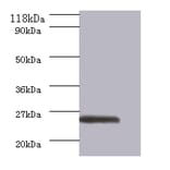 GTPase ERas Polyclonal Antibody from Signalway Antibody (42574) - Antibodies.com