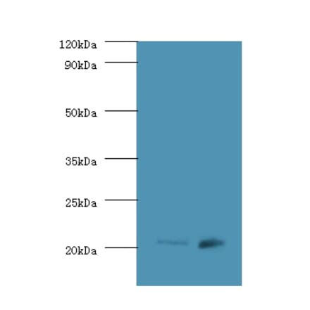 GTPase Hras Polyclonal Antibody from Signalway Antibody (42595) - Antibodies.com