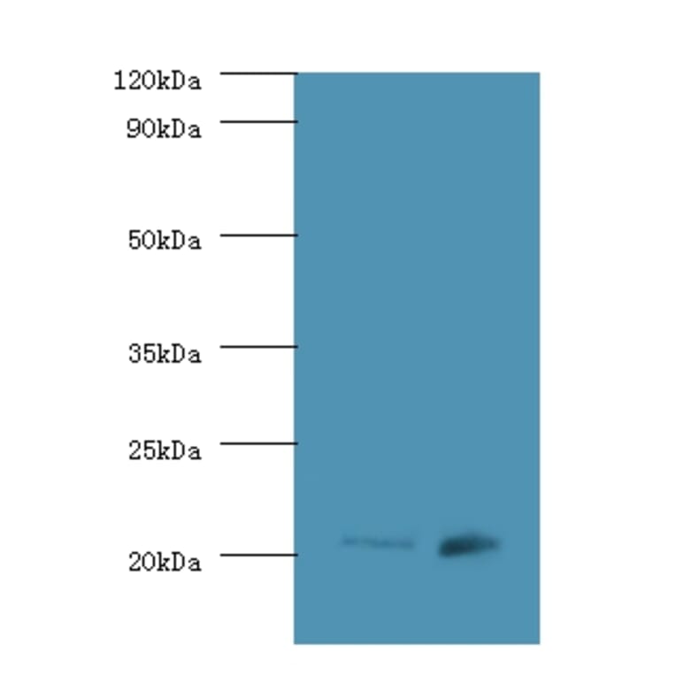 GTPase Hras Polyclonal Antibody from Signalway Antibody (42595) - Antibodies.com