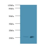 GTPase Hras Polyclonal Antibody from Signalway Antibody (42595) - Antibodies.com